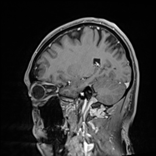 Click on the Serie image to view the images of VILLANUEVA, WILLIAM A.